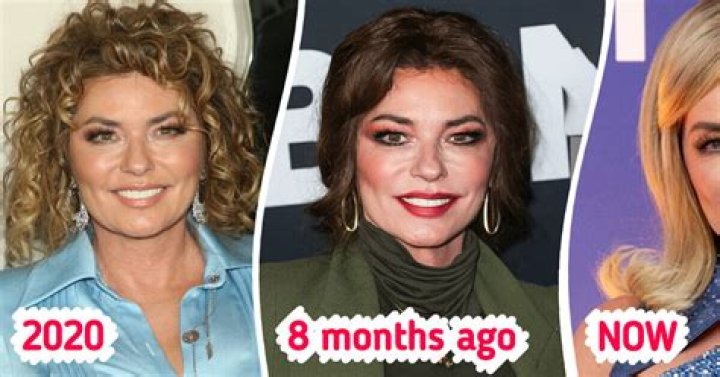 Shania Twain’s Plastic Surgery: New Look In 2023!